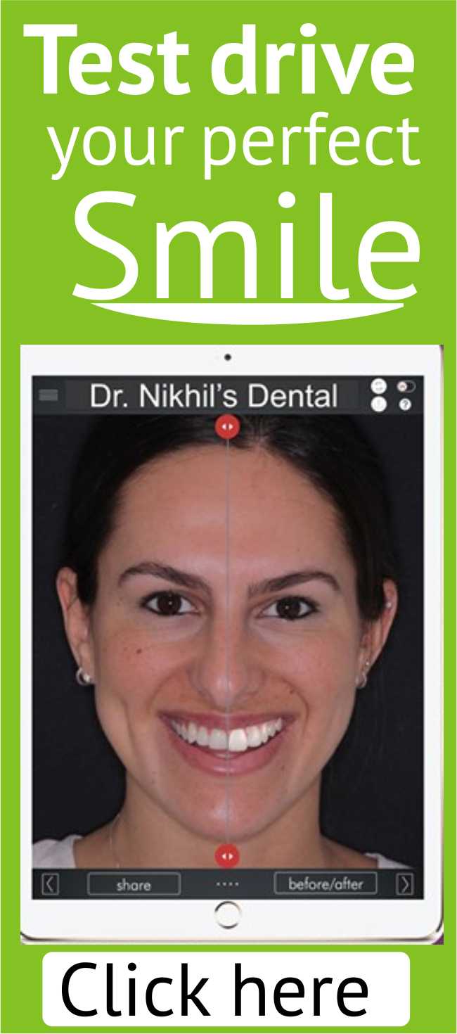 Smile design simulation