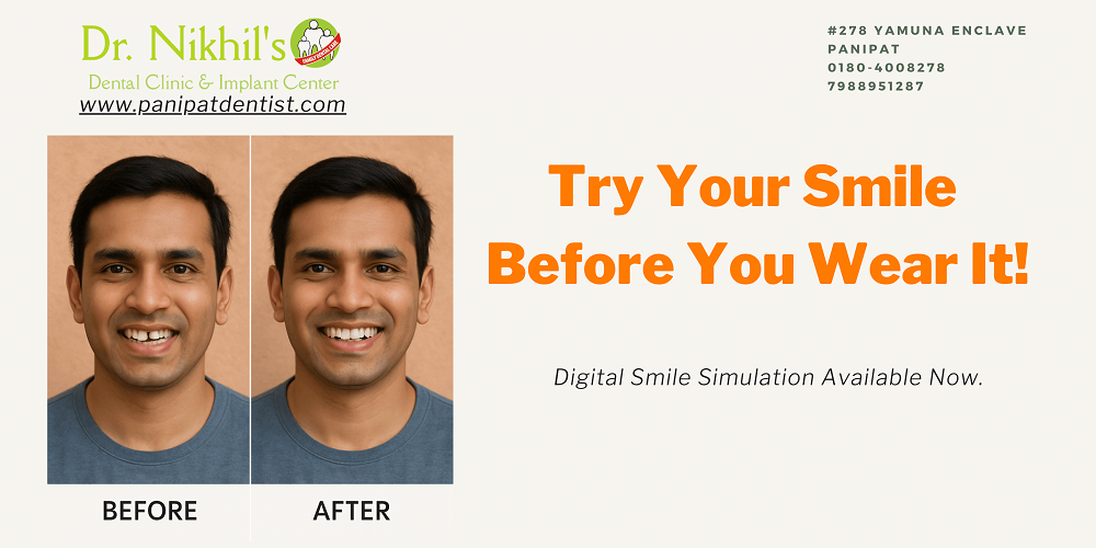 Smile Simulation
